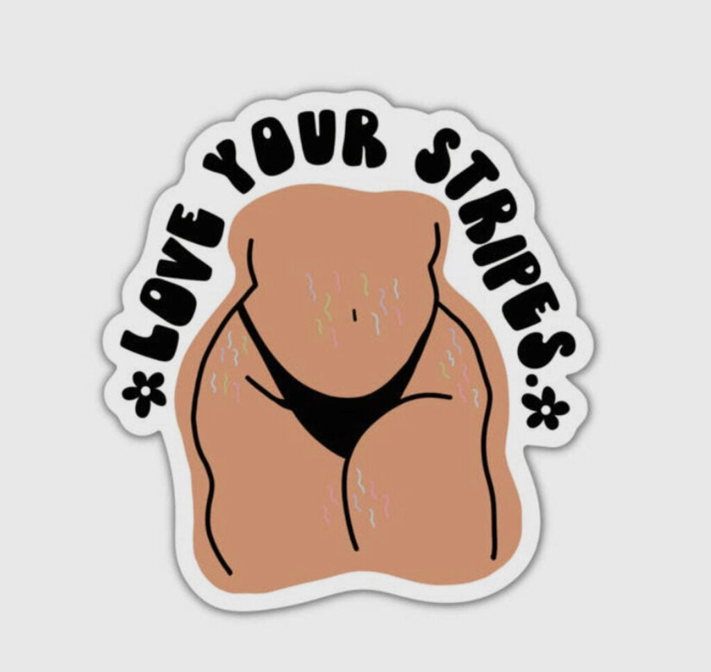 Love Your Stripes Vinyl Sticker
